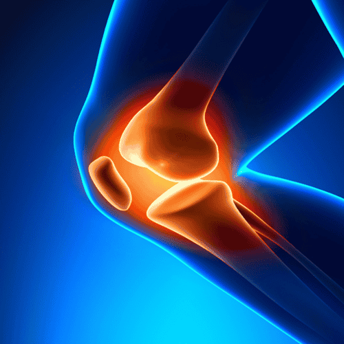 Life Improving Knee Replacement Surgery in Guangzhou China