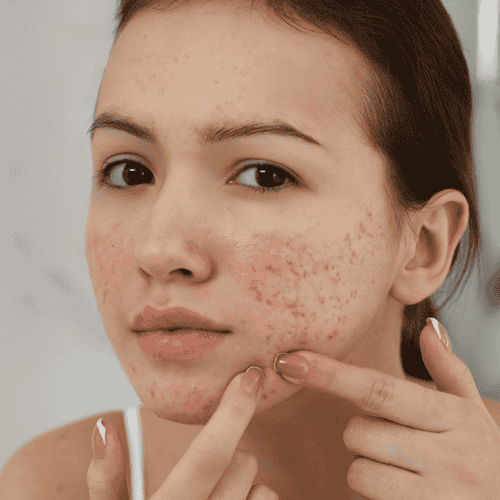 Affordable Stem Cell Mexico City Package for Scar Treatment by Dr. Ary Papadopulos