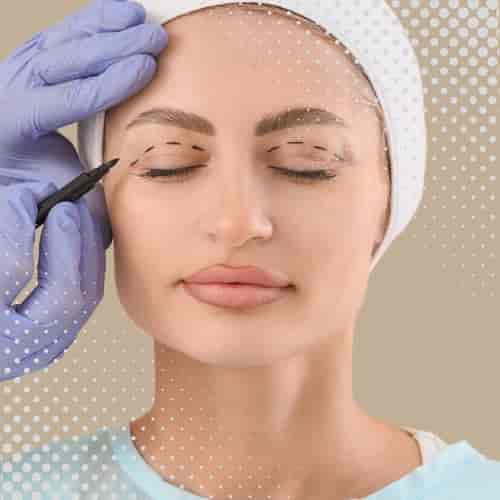 Eyelid Surgery Package in Yerevan, Armenia by Boroyan Plastic Surgery