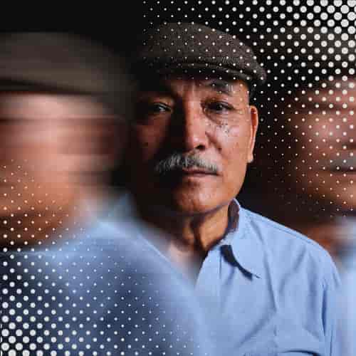 Top Package for Parkinson's Disease Stem Cell Treatment in Vienna, Austria