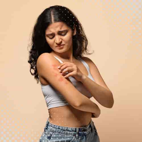 Premier Stem Cell Therapy for Psoriasis Package in Vienna, Austria by Stem Cells Austria