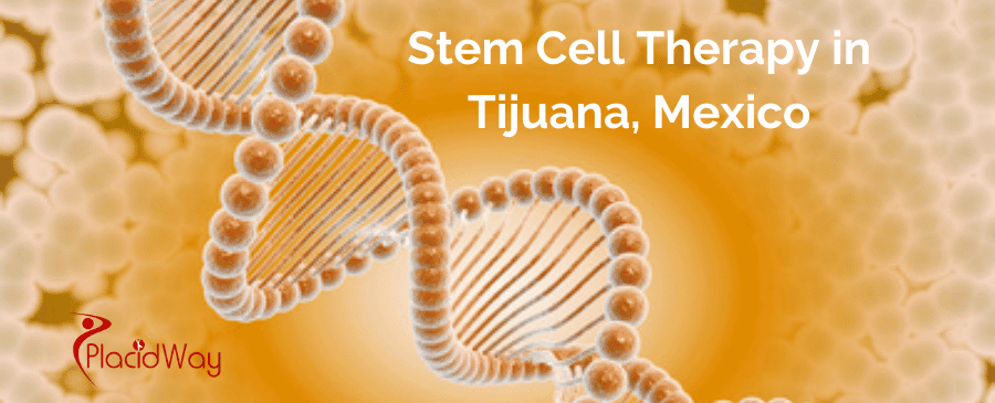 Stem Cell Tijuana: Affordable & High-Quality Treatments thumbnail
