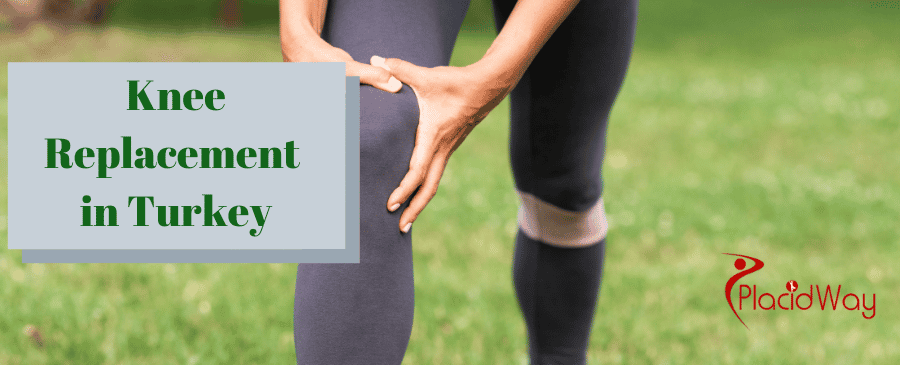 Knee Arthroplasty in Turkey by Top Orthopedic Clinics thumbnail