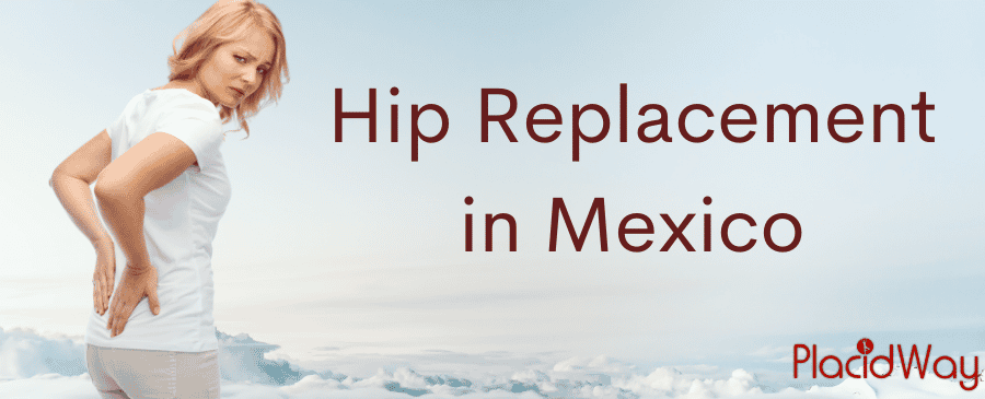 Hip Replacement in Mexico: Your Guide to Affordable and Quality Care thumbnail