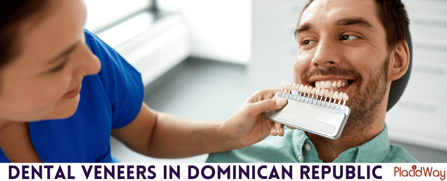 Dental Veneers in Dominican Republic - Affordable and Safe thumbnail