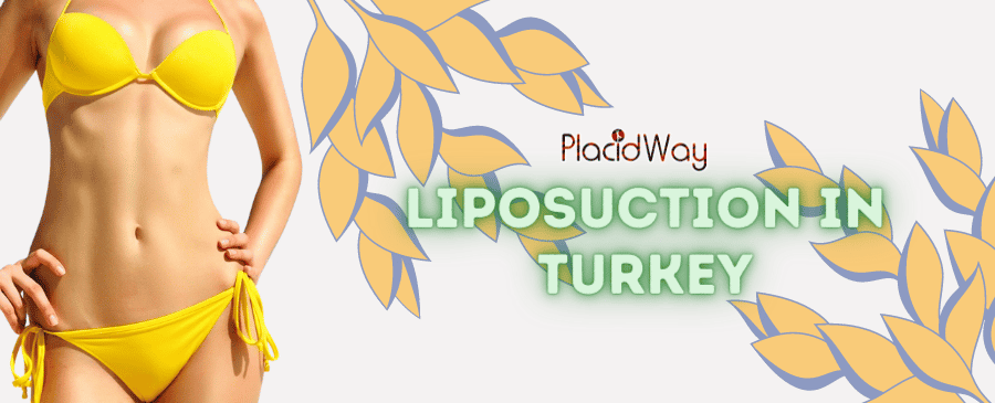 Affordable Liposuction in Turkey - Save Up to 75% thumbnail