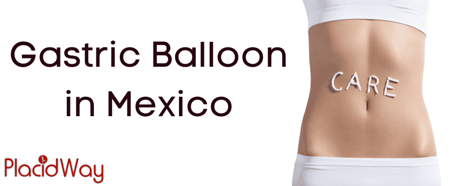 Gastric Balloon in Mexico thumbnail