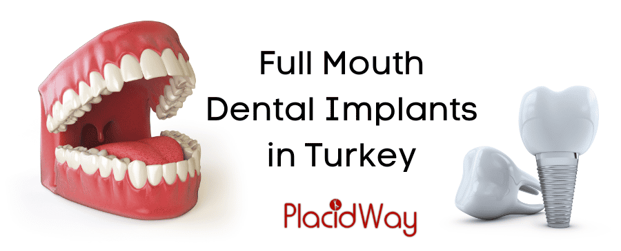 Full Mouth Dental Implants in Turkey - Affordable and Safe thumbnail