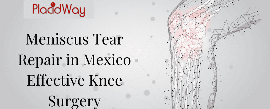 Meniscus Tear Repair in Mexico - Effective Knee Surgery thumbnail