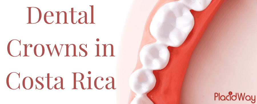 Dental Crowns in Costa Rica thumbnail