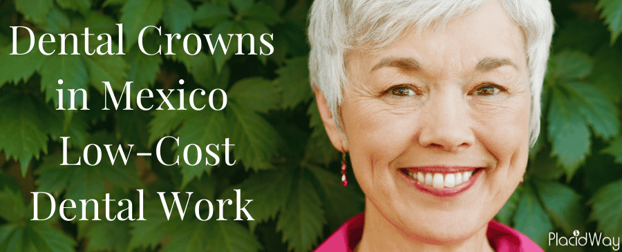 Dental Crowns in Mexico thumbnail