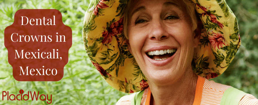 Dental Crowns in Mexicali: Top Dental Clinics and Dentists thumbnail