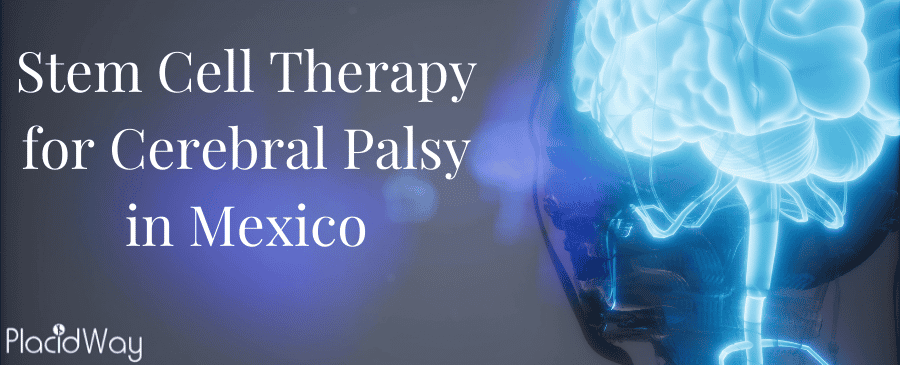 Stem Cell Therapy for Cerebral Palsy in Mexico thumbnail