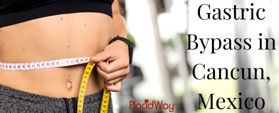 Gastric Bypass Cancun, Mexico thumbnail