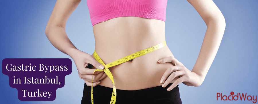 Affordable Gastric Bypass Surgery Istanbul – Get Free Quote Now! thumbnail