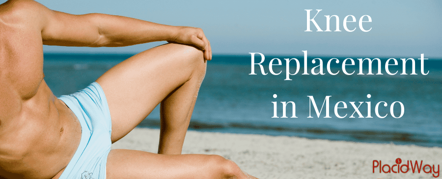 The Real Cost of Knee Replacement in Mexico: A Detailed Price Breakdown thumbnail