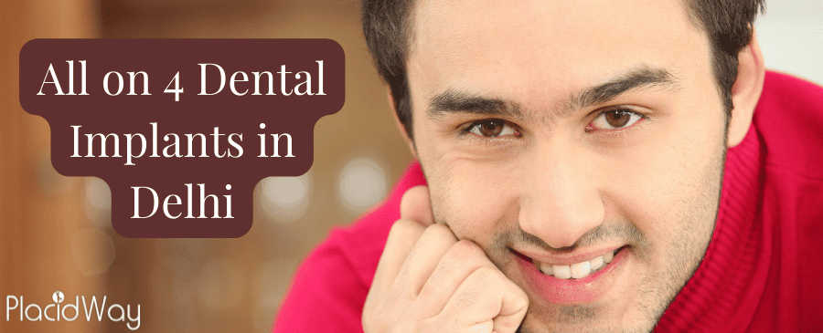 All on 4 Dental Implants in Delhi - Get Perfect Smile thumbnail