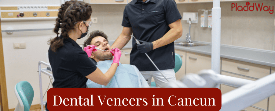 Dental Veneers in Cancun, Mexico thumbnail