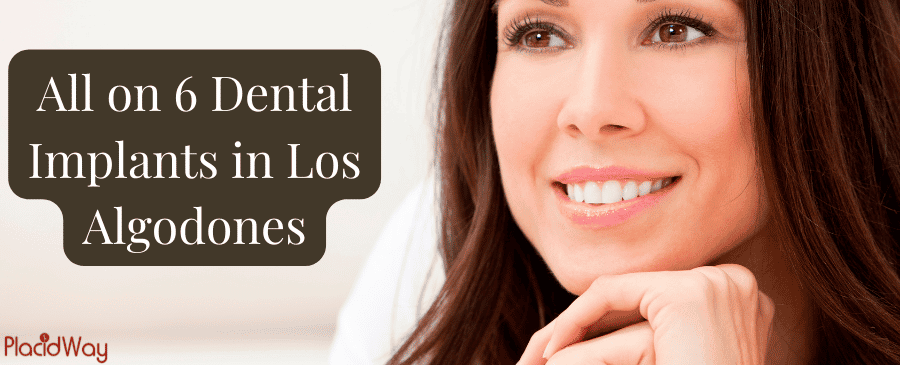All on 6 Dental Implants in Los Algodones, Mexico thumbnail