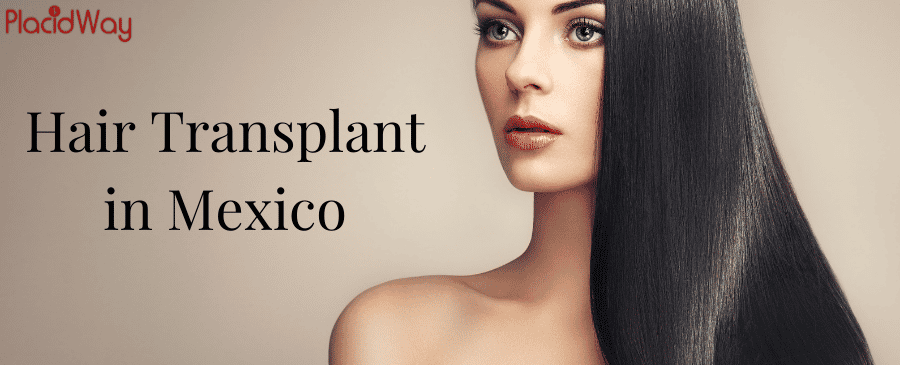 The Guide to Choosing Hair Transplant in Mexico thumbnail