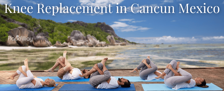 Best Knee Replacement in Cancun Mexico from Top-Rated Hospital thumbnail