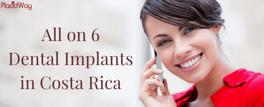 All on 6 Dental Implants in Costa Rica thumbnail