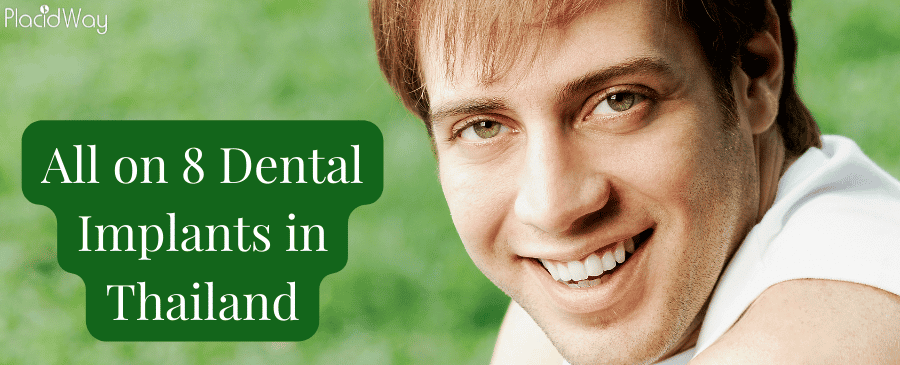 All on 8 Dental Implants in Thailand - Get Dental Implants Abroad  thumbnail
