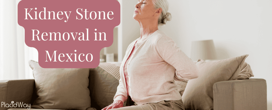 Kidney Stone Removal Surgery in Mexico thumbnail