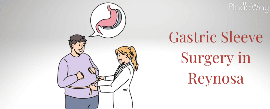 Gastric Sleeve Surgery in Reynosa, Mexico thumbnail