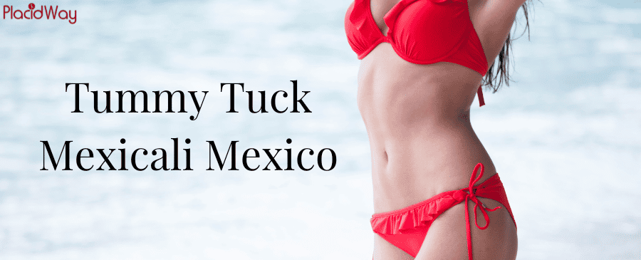 Tummy Tuck in Mexicali, Mexico thumbnail