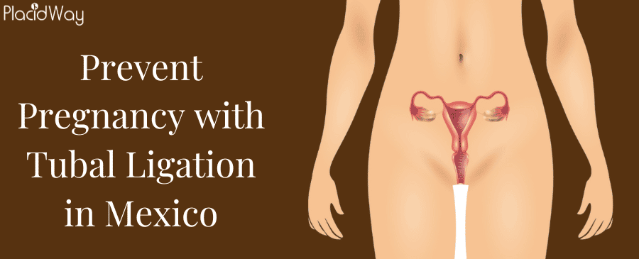 Prevent Pregnancy with Tubal Ligation in Mexico thumbnail