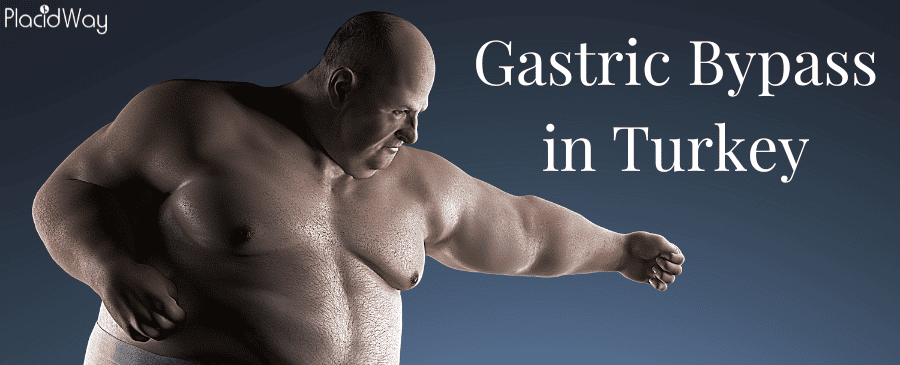 Gastric Bypass in Turkey - Cost, Clinics, Reviews, Doctors thumbnail