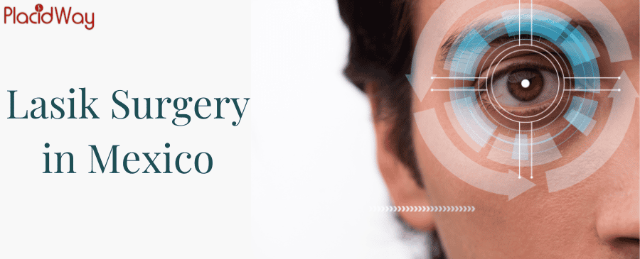 Lasik Surgery in Mexico thumbnail