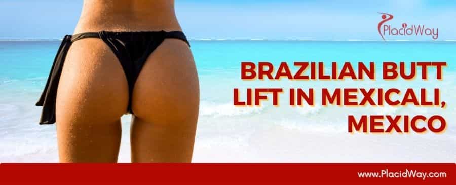 Brazilian Butt Lift in Mexicali, Mexico thumbnail