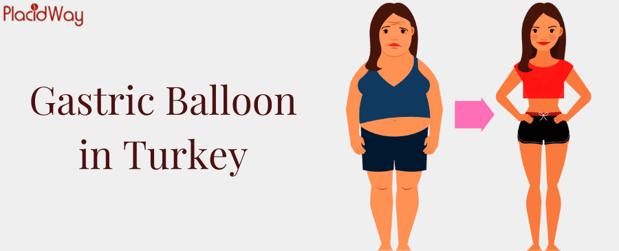 Gastric Balloon in Turkey thumbnail