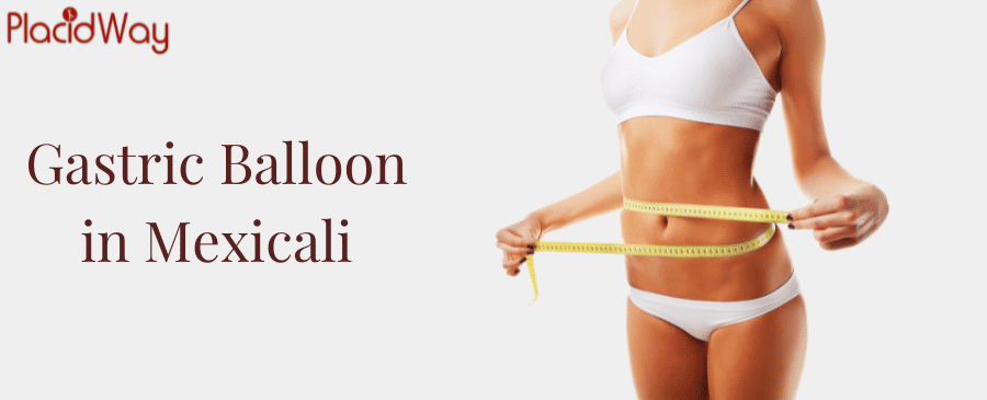 Gastric Balloon in Mexicali, Mexico thumbnail