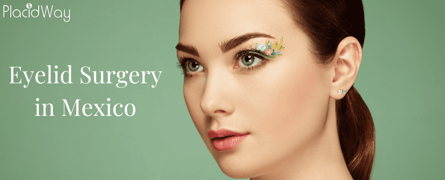Eyelid Surgery in Mexico thumbnail