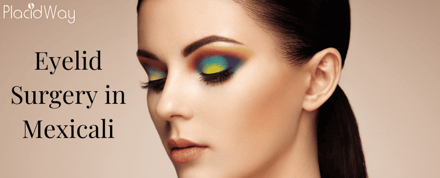 Eyelid Surgery in Mexicali thumbnail