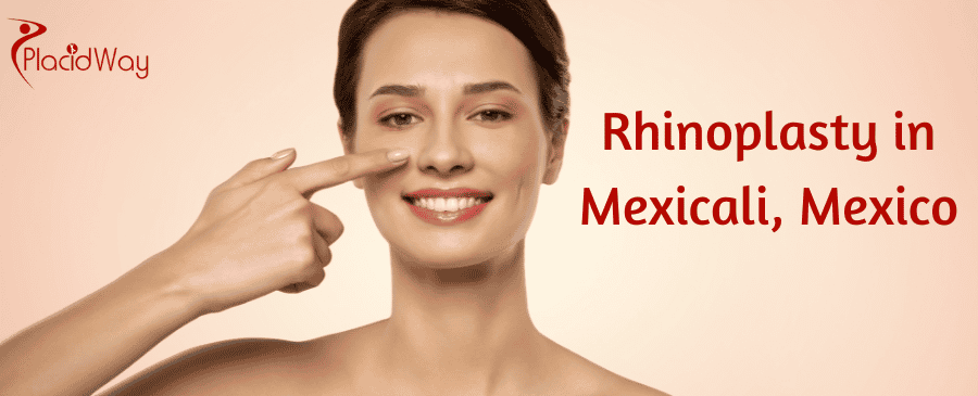 Rhinoplasty in Mexicali, Mexico thumbnail