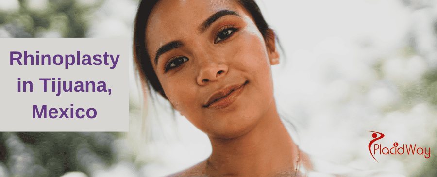 Rhinoplasty in Tijuana thumbnail