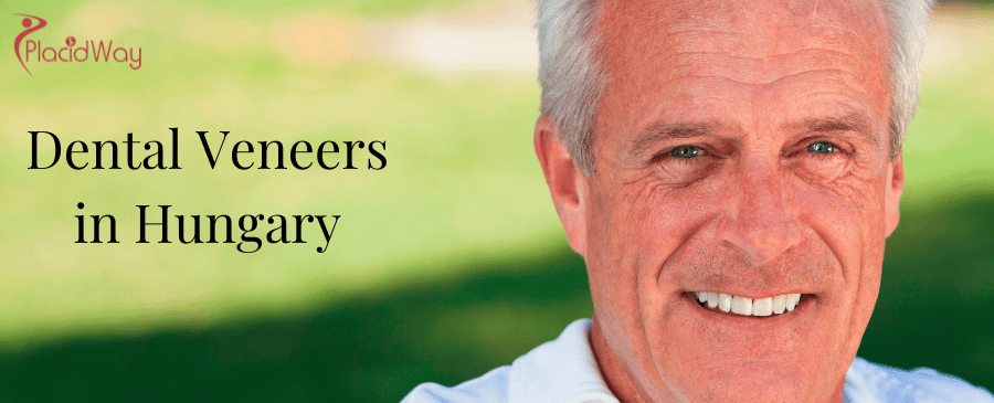 Dental Veneers in Hungary thumbnail