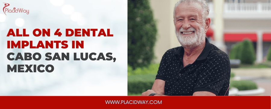 All on 4 Implants in Cabo San Lucas thumbnail