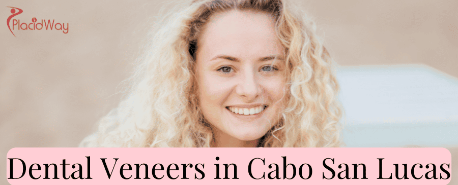Dental Veneers in Cabo San Lucas thumbnail