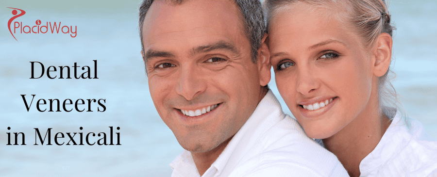 Dental Veneers in Mexicali thumbnail