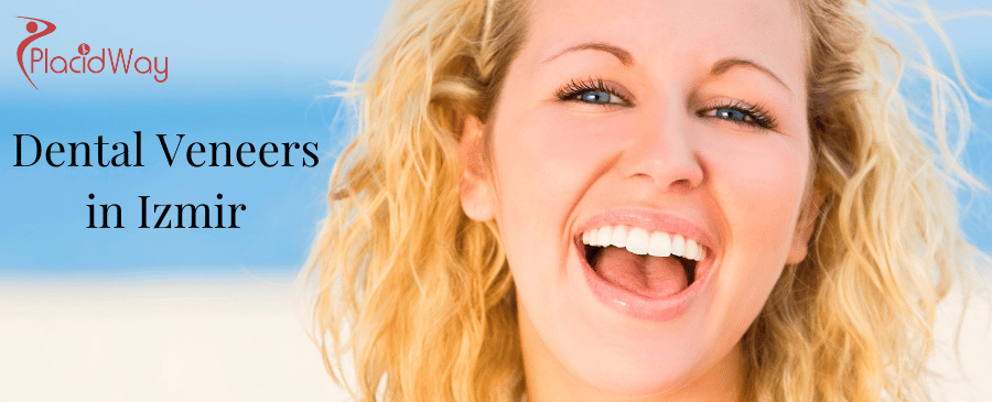 Dental Veneers in Izmir, Turkey thumbnail