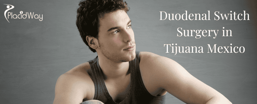 Duodenal Switch Surgery in Tijuana Mexico thumbnail