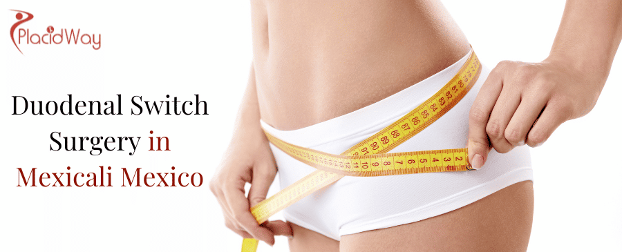 Duodenal Switch Surgery in Mexicali Mexico thumbnail