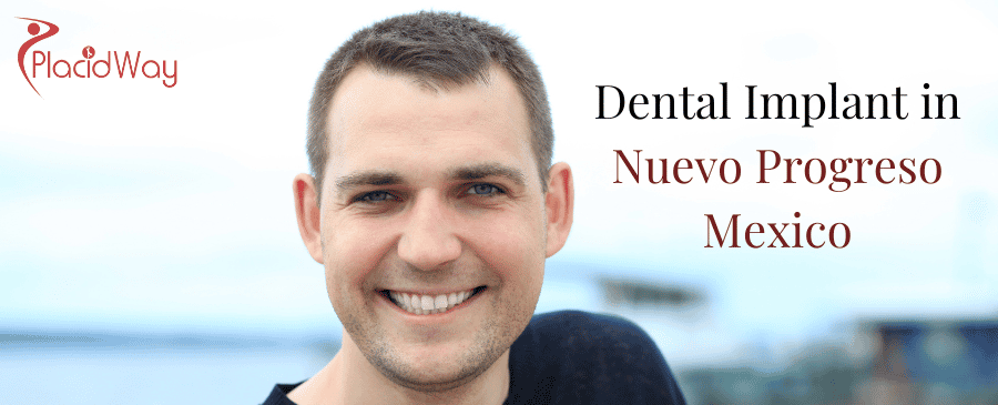 Dental Implant in Nuevo Progreso Mexico thumbnail