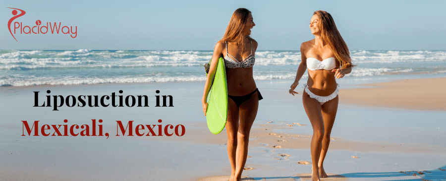 Liposuction in Mexicali, Mexico thumbnail