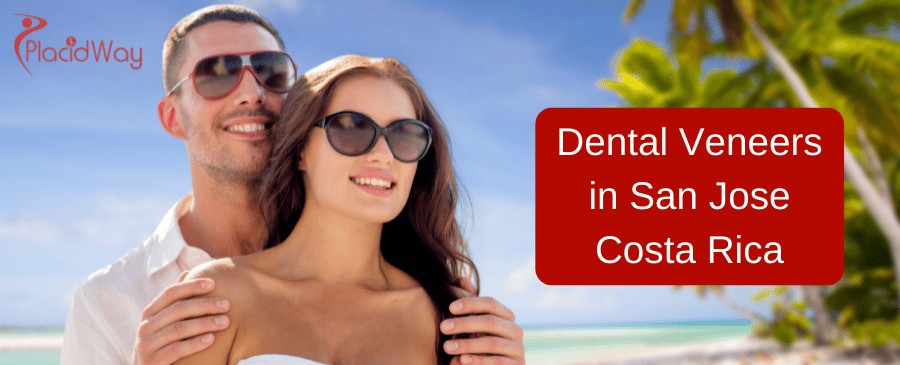 Dental Veneers in San Jose Costa Rica thumbnail